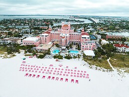 The Don CeSar