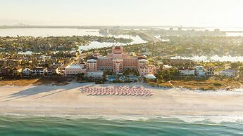 The Don CeSar